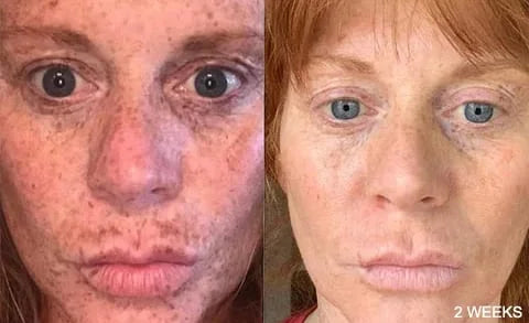 ShahSyl™Turmeric Anti-Oxidation Serum - Rejuvenate and Protect Your Skin