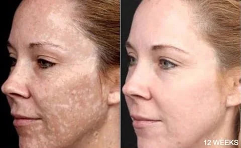 ShahSyl™Turmeric Anti-Oxidation Serum - Rejuvenate and Protect Your Skin